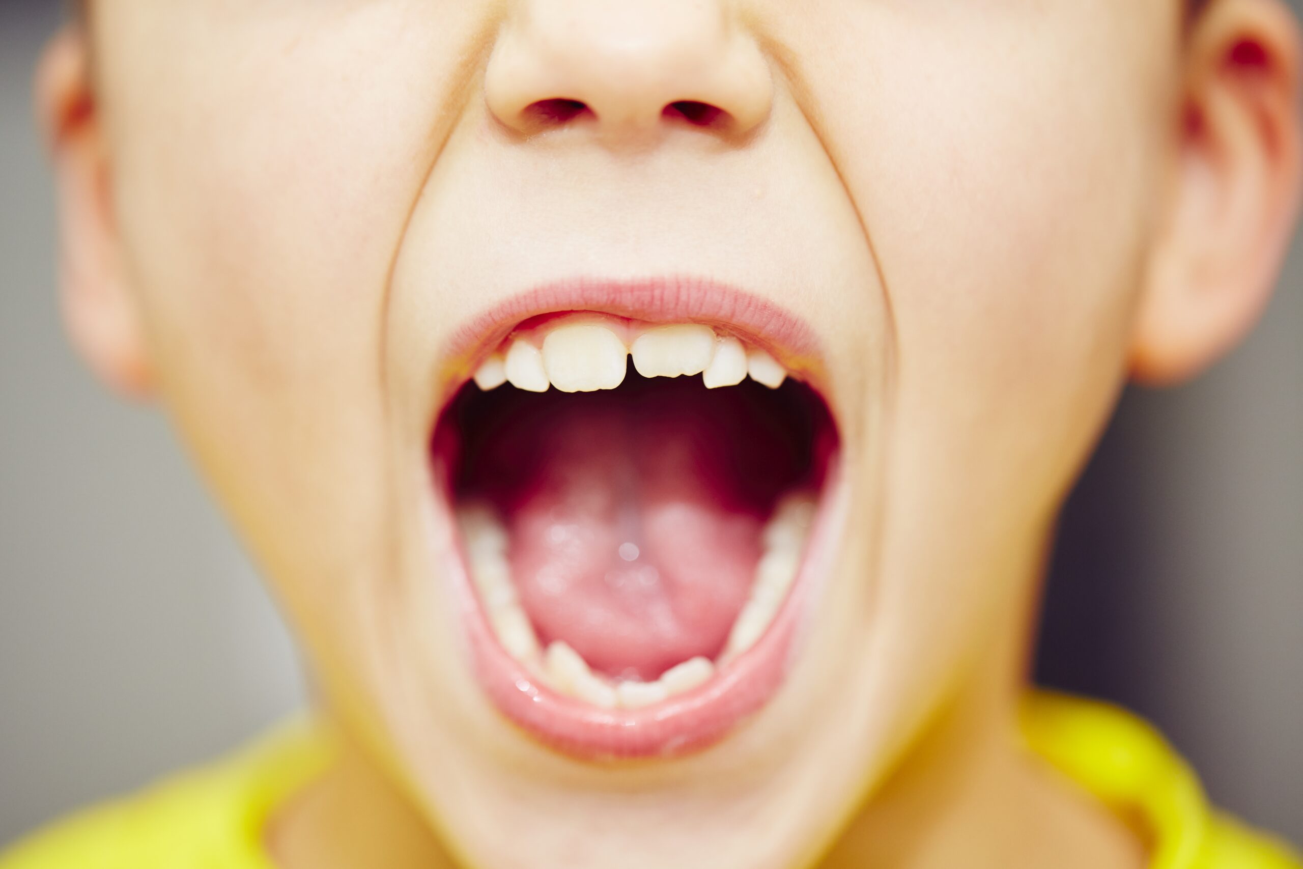 Teeth grinding in children