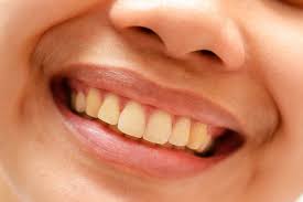 Healthy yellow teeth