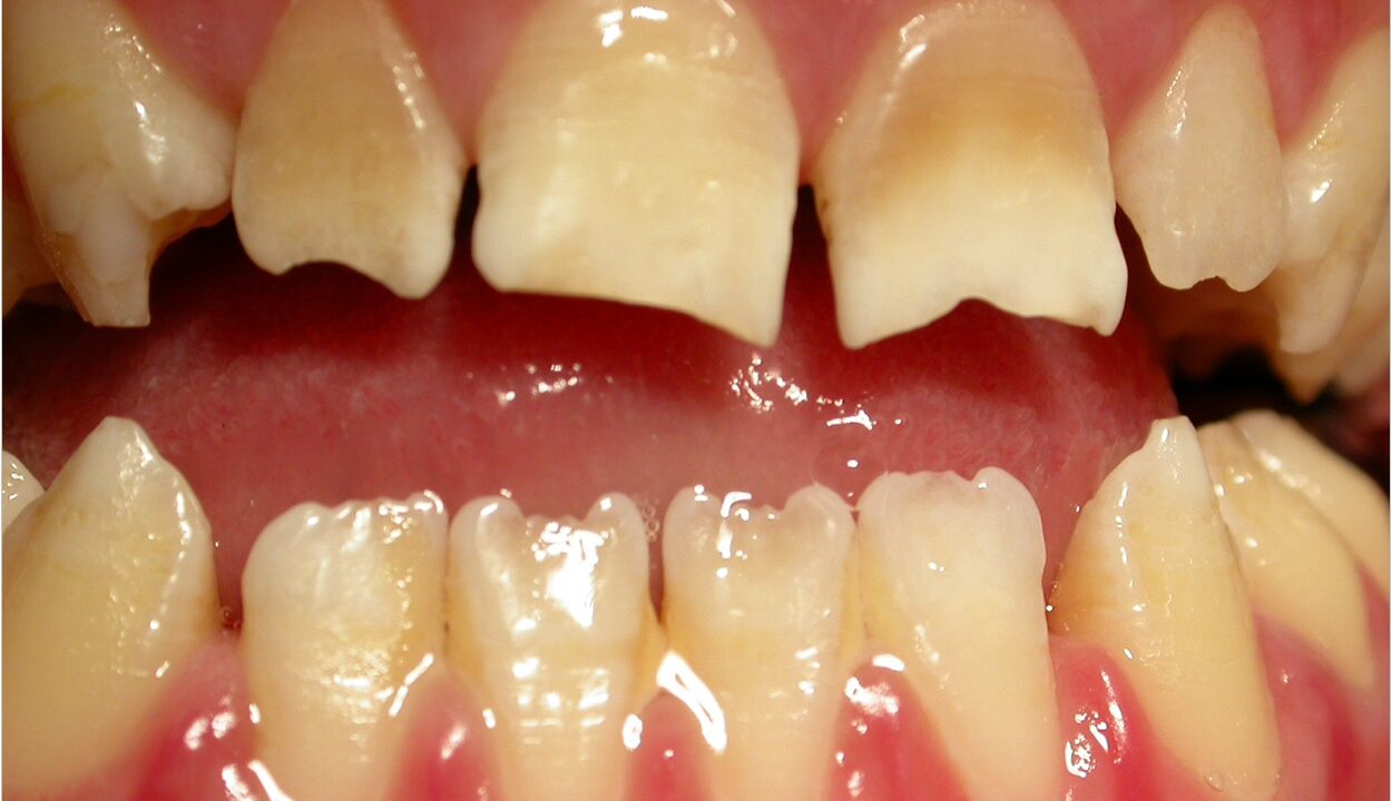 ugly-looking teeth