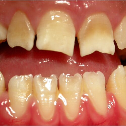 ugly-looking teeth