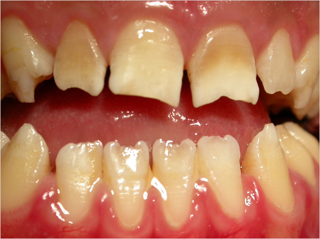 ugly-looking teeth