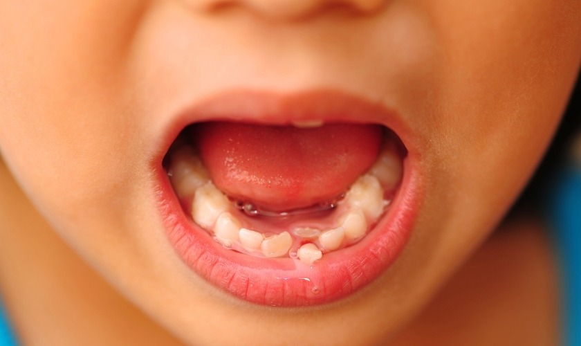 Baby Teeth Shedding