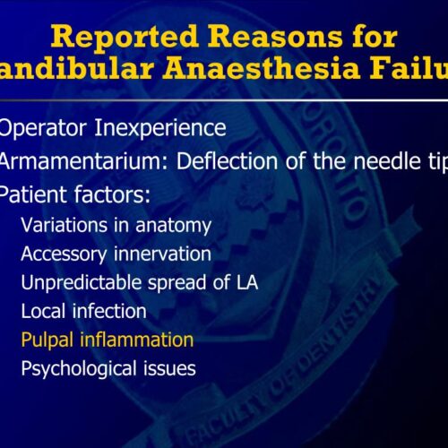 Causes of mandibular anaesthesia failure