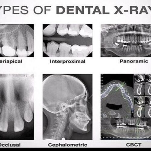 Dental X-rays