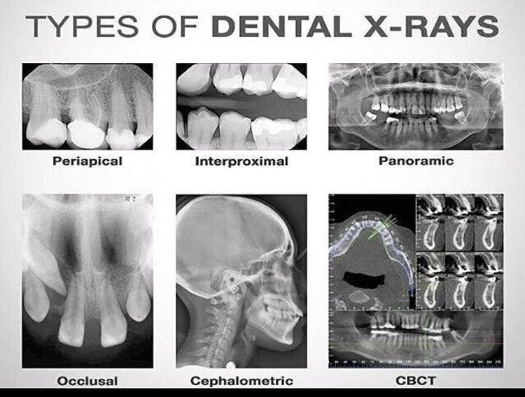 Dental X-rays