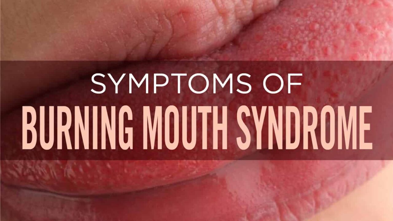 Burning Mouth Syndrome