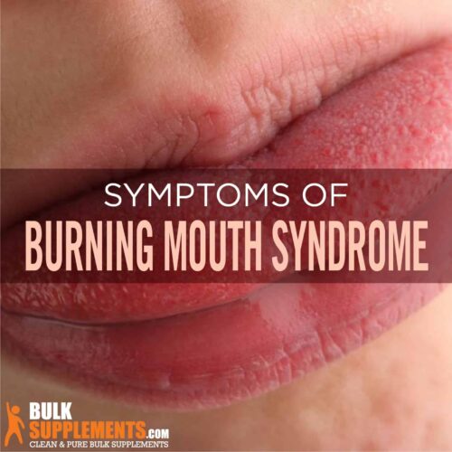 Burning Mouth syndrome
