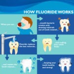 Possibility of Having Fluoride Allergy