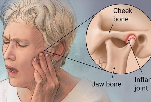 jaw joint pain