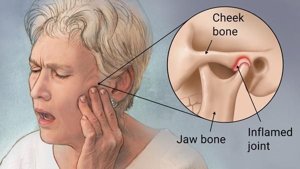 jaw joint pain