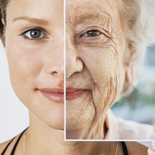 aging