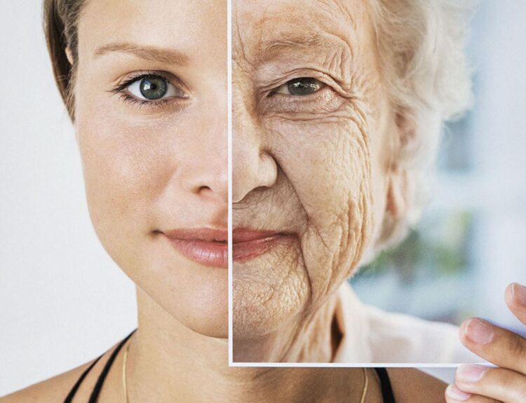 aging