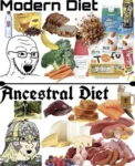 Modern Diet and Smaller Jaws: Impact on Wisdom Teeth