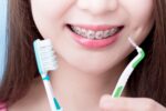 Periodontal Brushes: An Essential Tool for Ideal Gum Health 