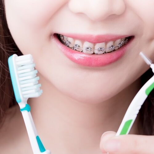 interdental brushes