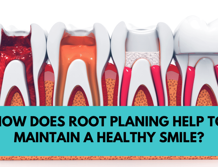 Root Planing