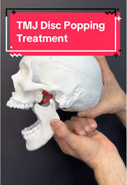 TMJ clicking & popping