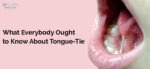 Ankyloglossia – Tongue Tie